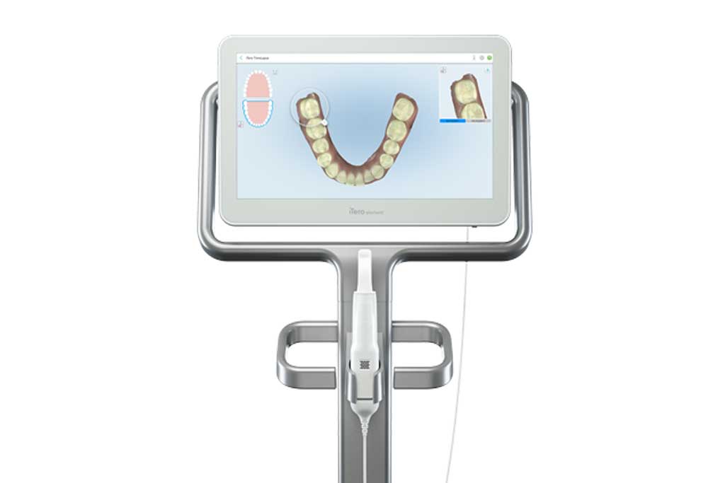 iTero digital dental scanner
