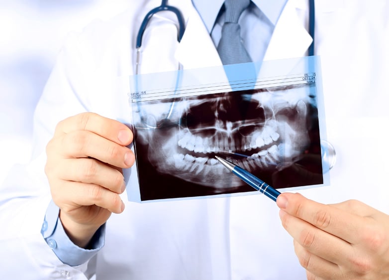 Dentist reviewing a panoramic dental X-ray