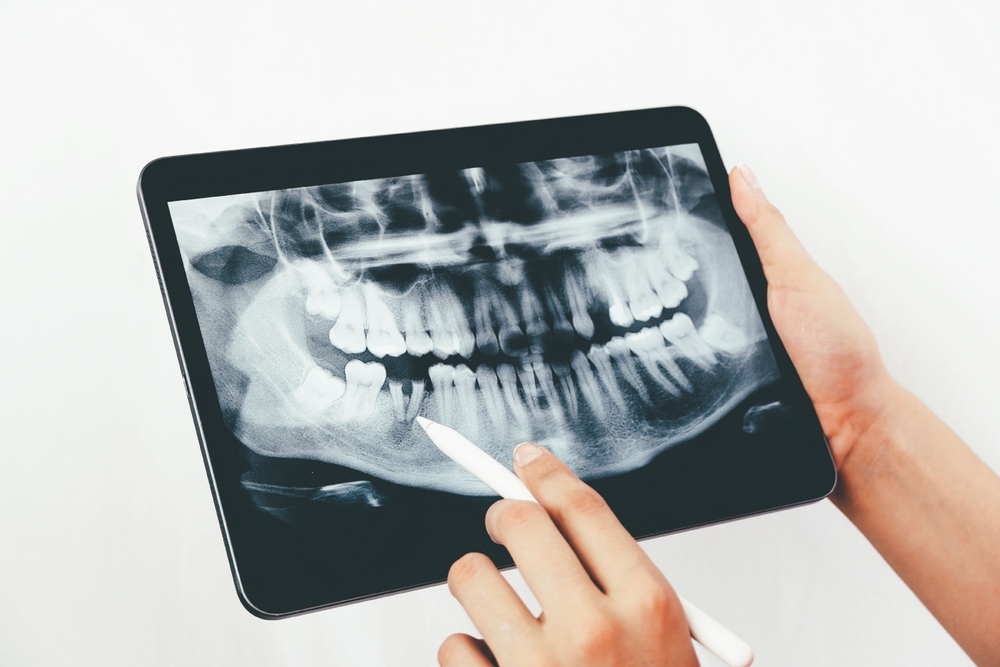 Digital panoramic dental image on a tablet